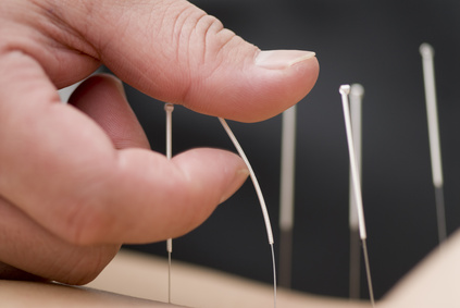 L'acupuncture fait-elle mincir ?